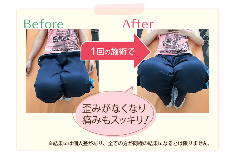 歪みがなくなり痛みもスッキリ