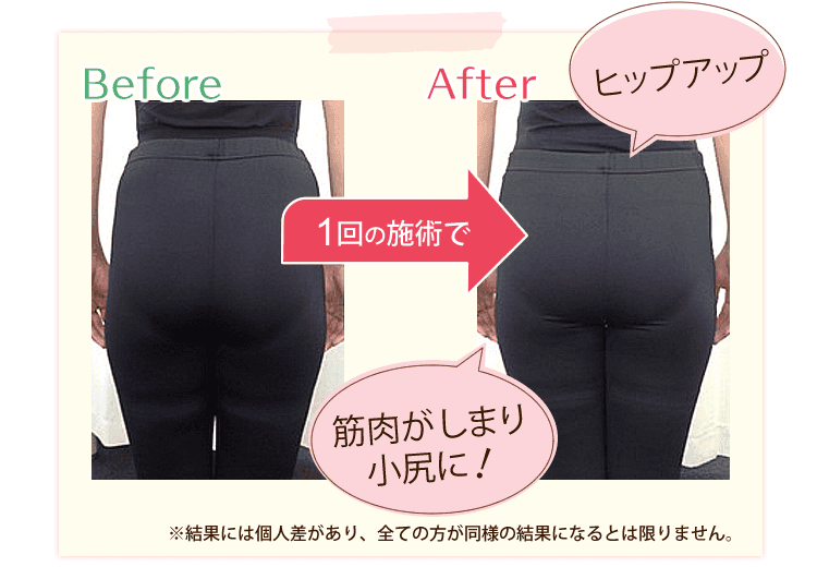 筋肉がしまり小尻に